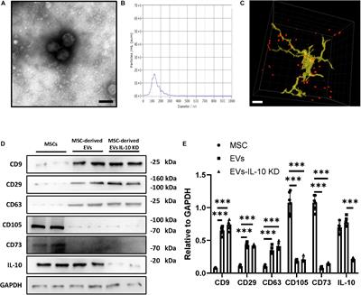 Mesenchymal-Stem-Cell–Derived Extracellular Vesicles Mitigate Trained Immunity in the Brain